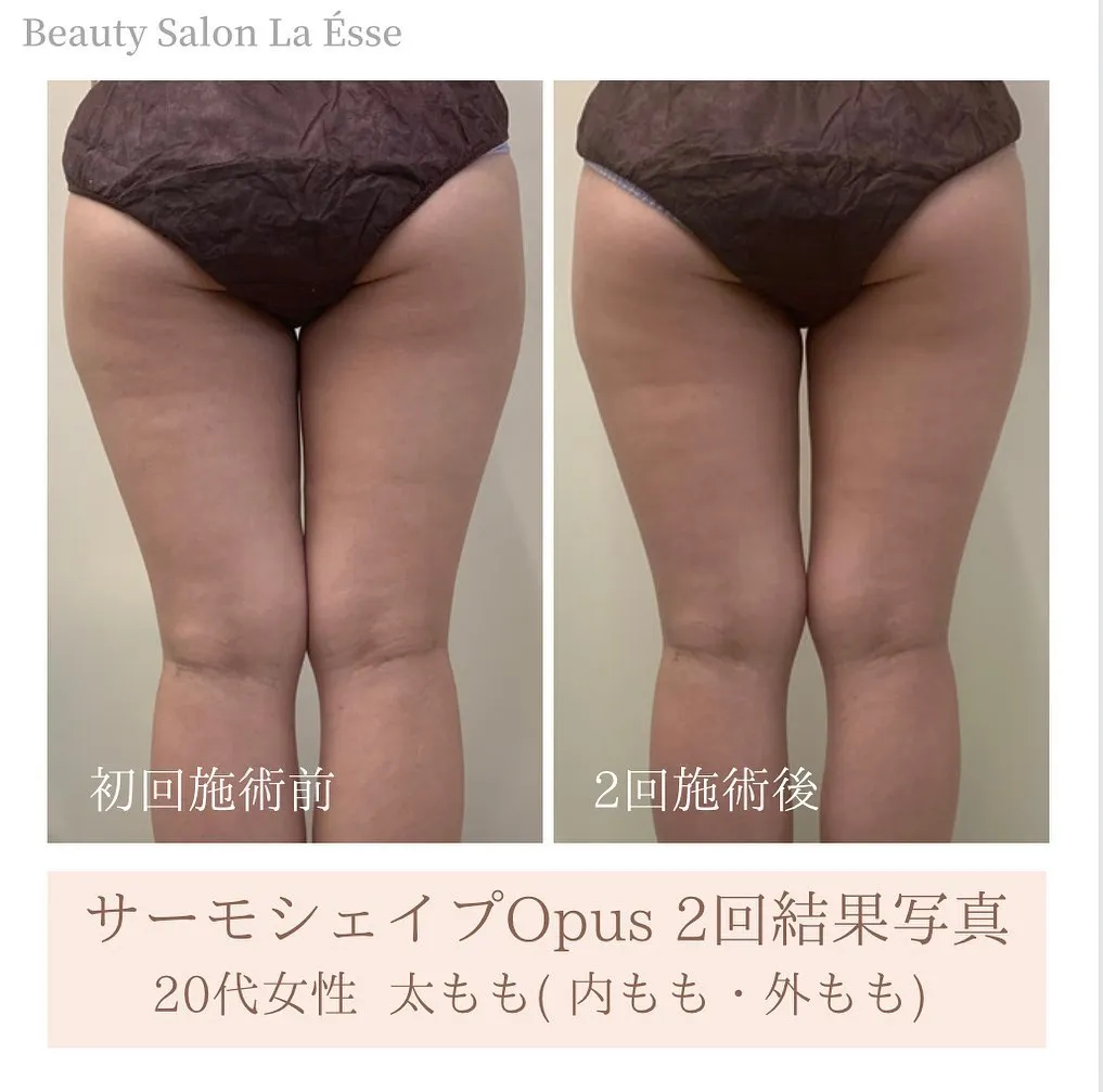 下半身太り解消！ヒップアップで脚長効果も ブログ 烏丸のエステならbeauty Salon La Ésse 