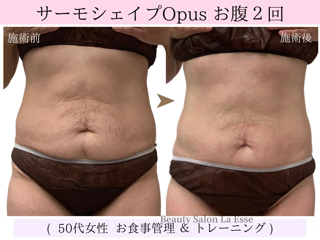 【お腹｜腰｜中半身痩せ】