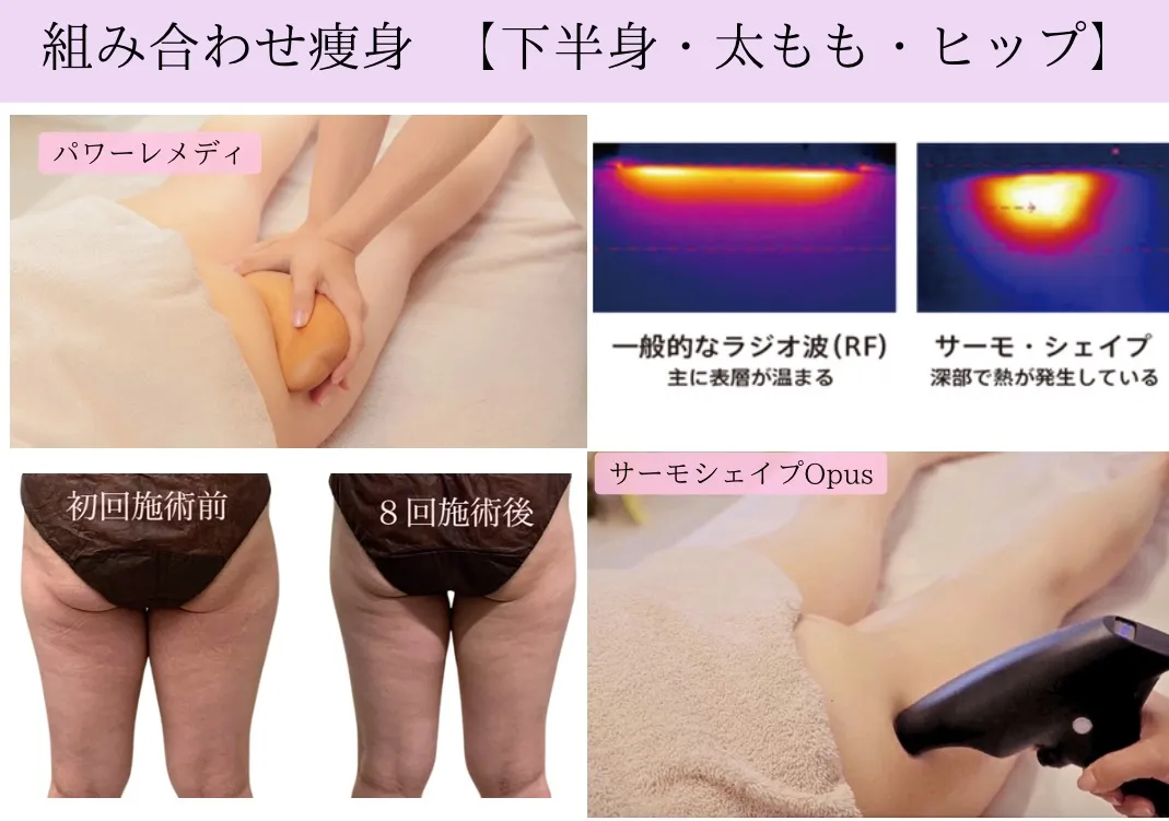 太もものサイズダウンや下半身痩せ