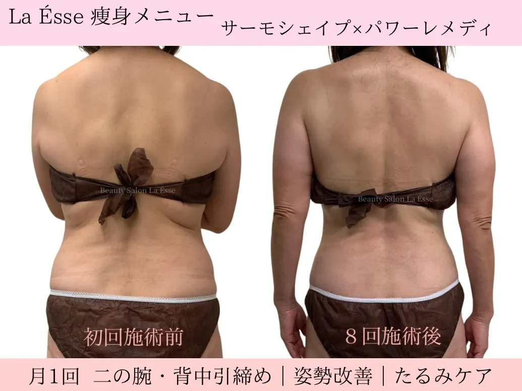 【ブライダル・背中痩せ】