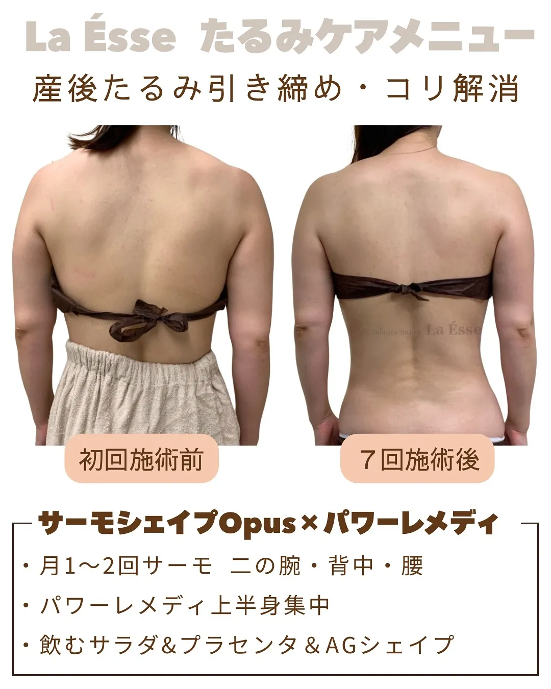 産後放置しがちの背中のたるみも若々しく引き締めちゃう🔥