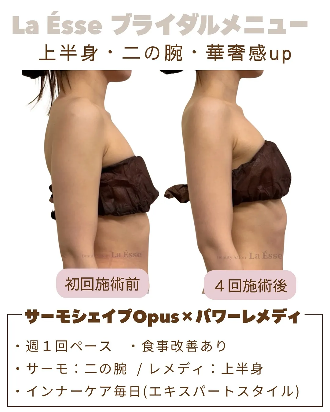 二の腕をきゅっと引き締め美しいドレス姿へ🫶🏻💞