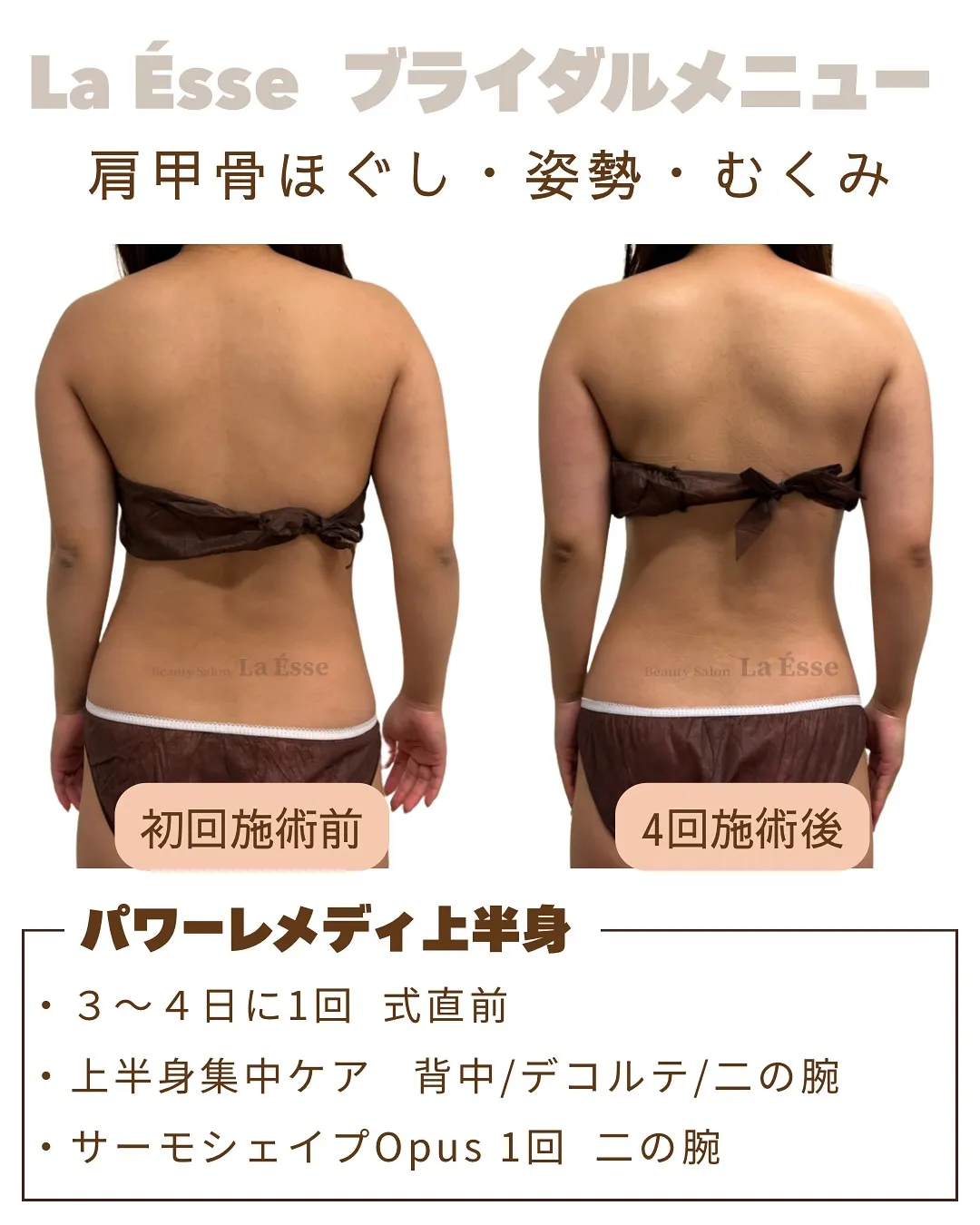 ドレスから“天使のはね🪽”がのぞく背中へ✨ 極上筋膜リリース...