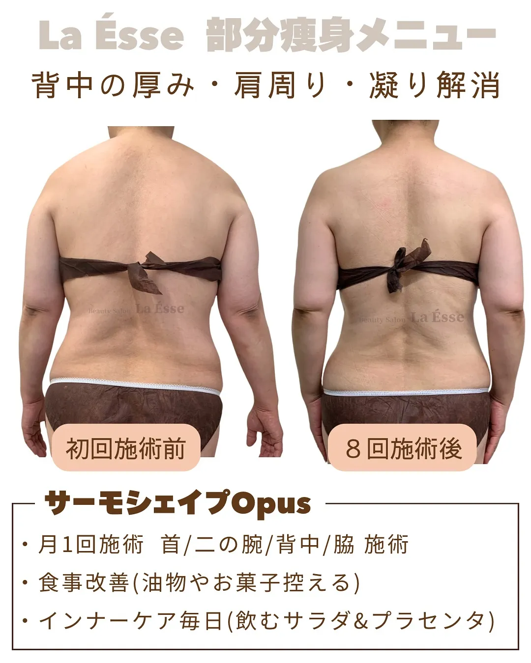 すっきり背中で、印象－10歳へ✨  サーモシェイプで背中美人...