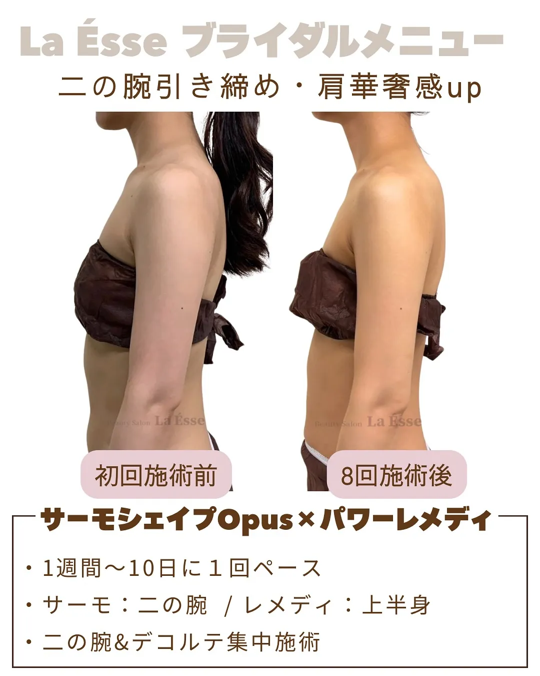 ドレス映えする上半身創り👰🏻‍♀️💖 きゅっと引き締まった二...