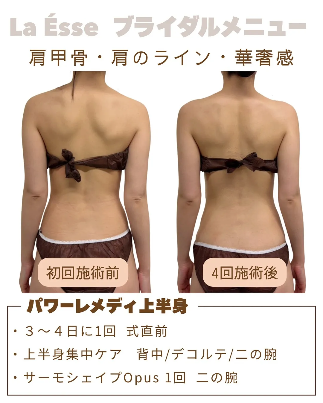 背中も肩甲骨も美しくドレス映え👰🏻‍♀️ 花嫁様必見！！💍