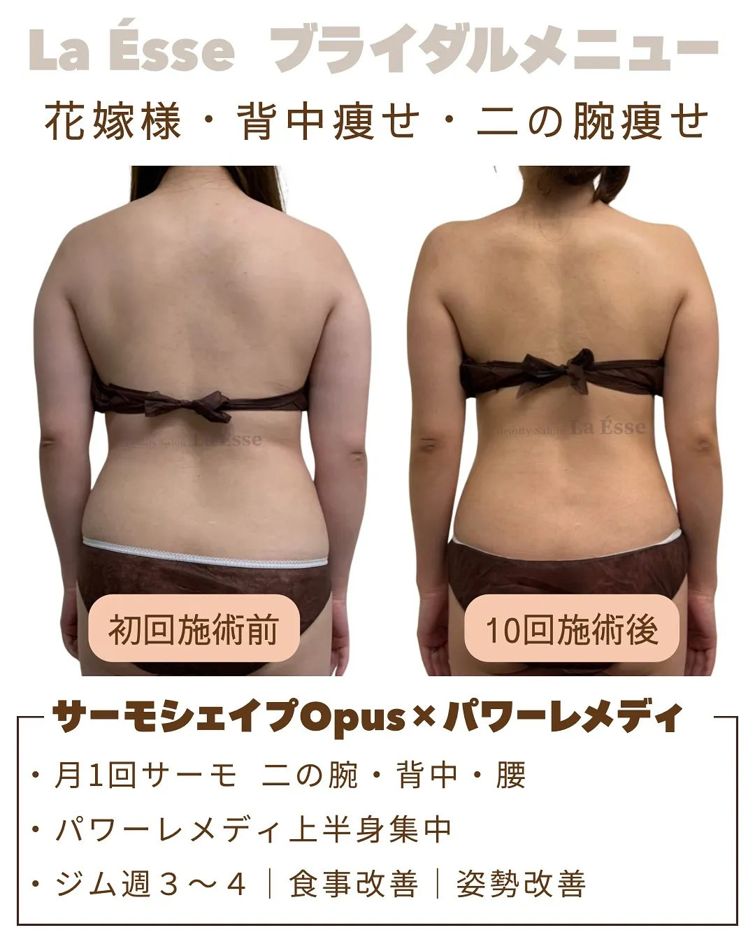 花嫁様必見！１ヶ月に１回💎 施術×運動の相乗効果で別人級に👏...