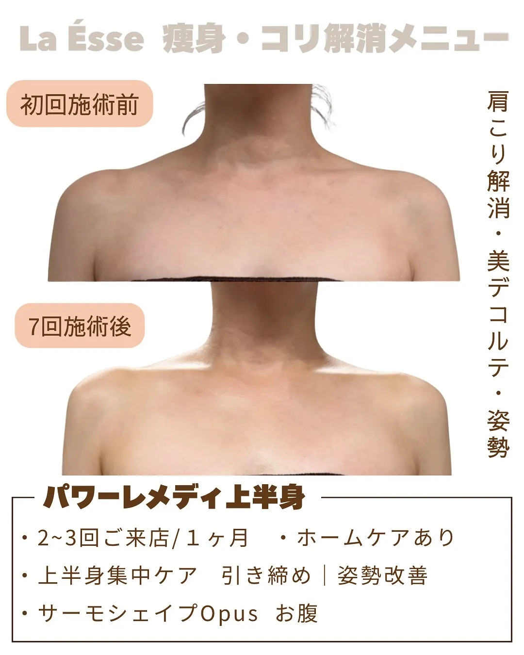 盛り肩卒業!自信が持てるデコルテへ😍✨ 烏丸エステサロン