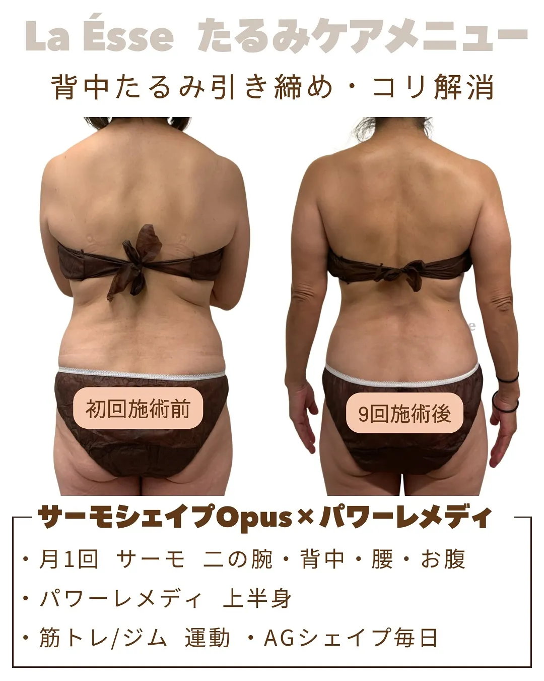 隠しきれない【年齢サイン】背中に出ていませんか？🥹 ぷにっと...