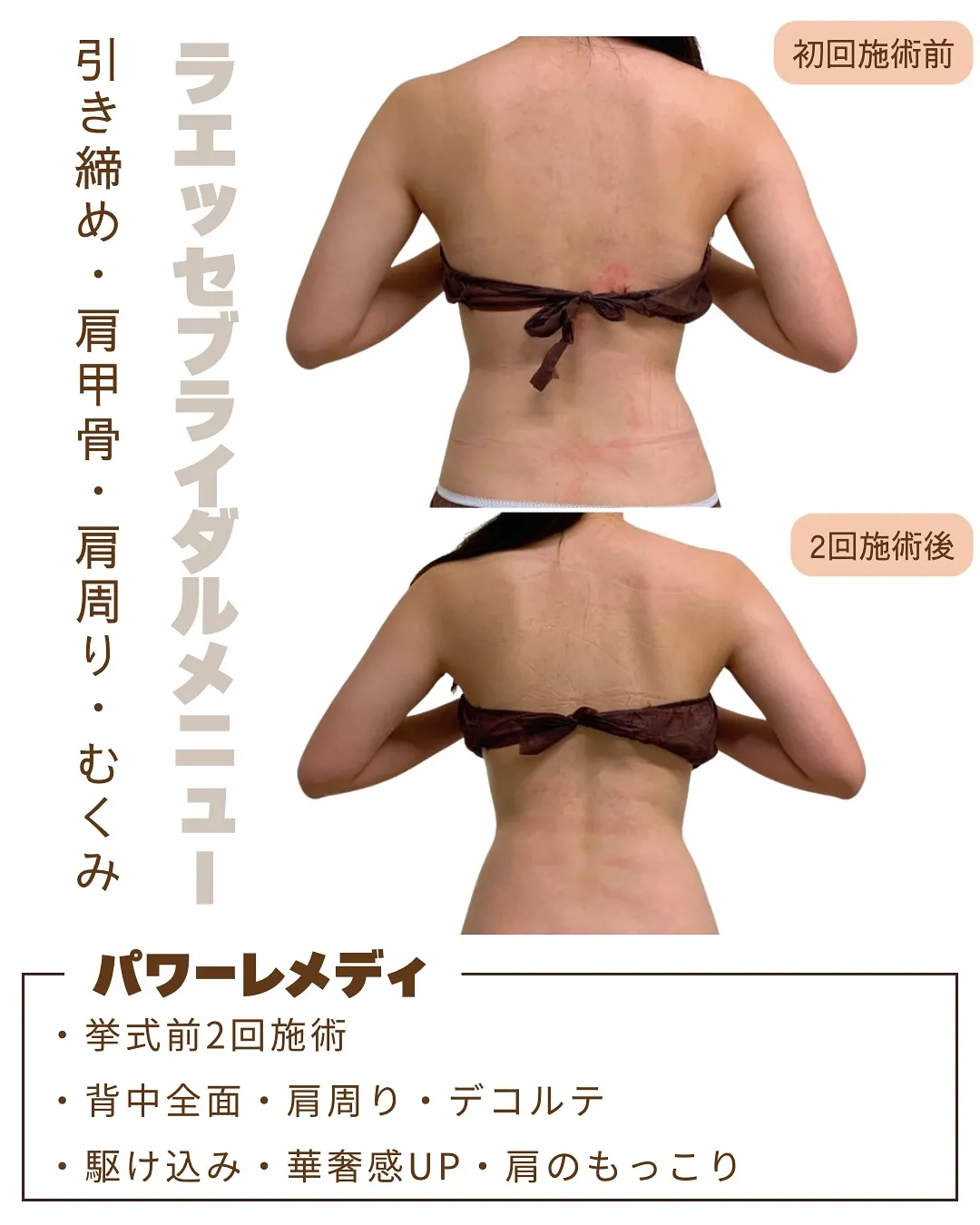 細いお客様でも華奢感UPで美しいお背中へ💖 美造形術*パワー...