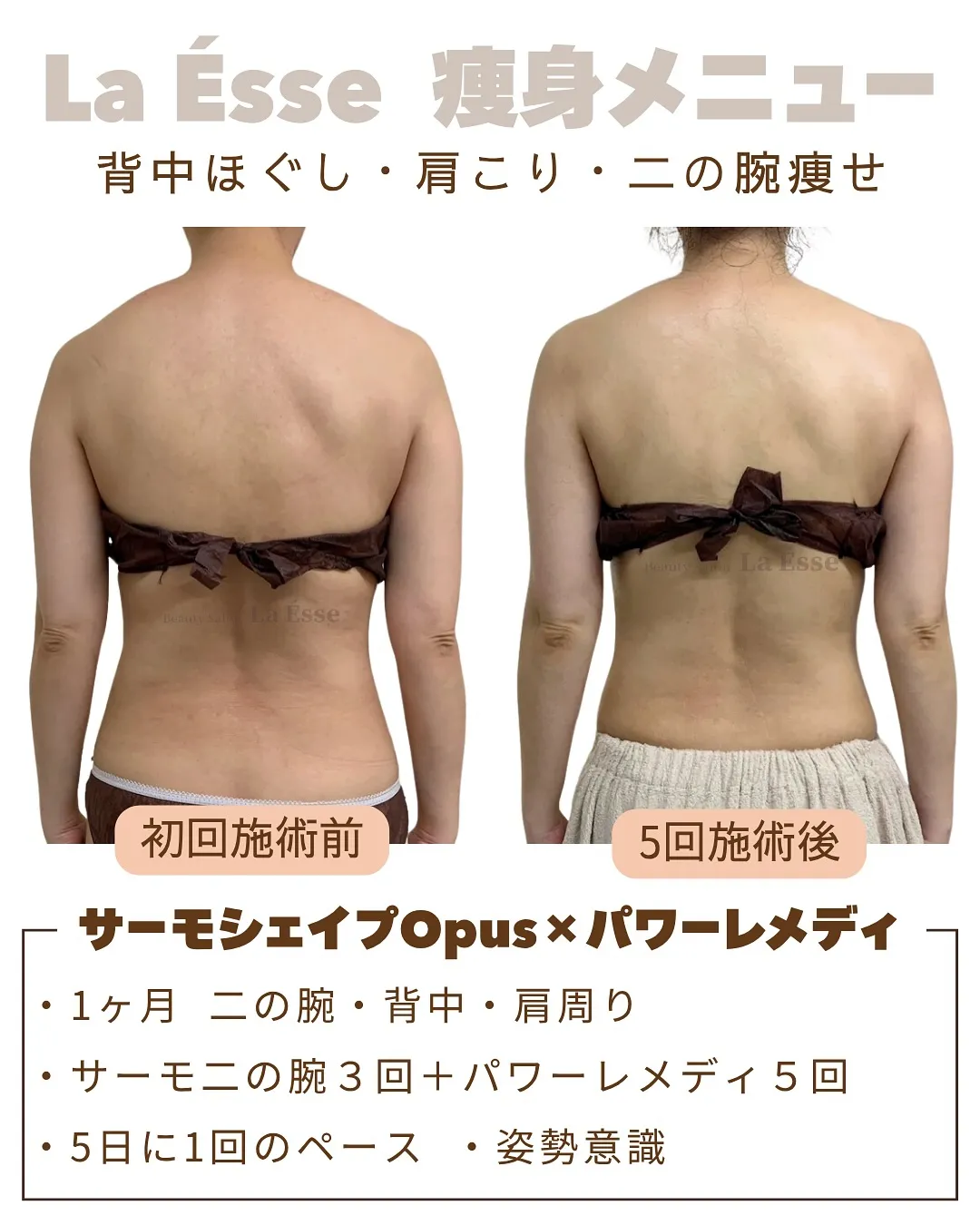 ストレスなく短期痩せ!肩こりまでほぐれて一石二鳥の痩身エステ...