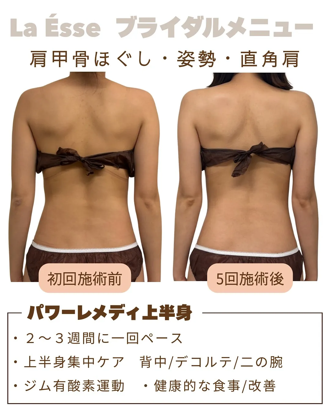 極上筋膜リリースで美しいドレス映えする後ろ姿へ🪞👰🏻♀️