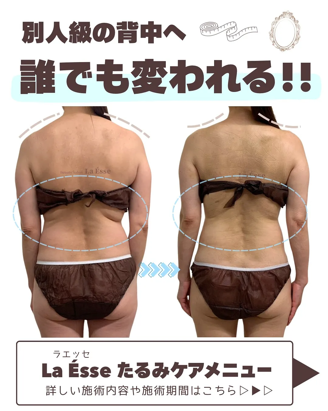 極上筋膜リリースで美しい背中へ✨️ マイナス10歳の後ろ姿を...