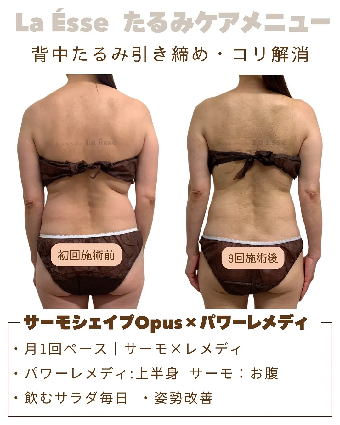 極上筋膜リリースで美しい背中へ✨️ マイナス10歳の後ろ姿を...