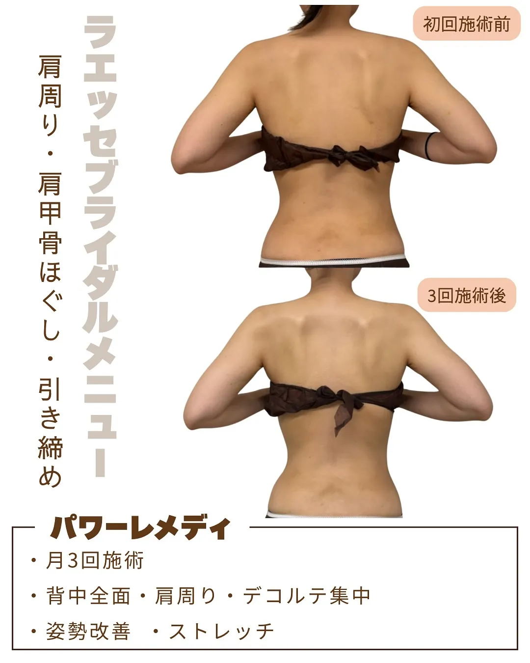 短期間でも後ろ姿が美しく変わるだけで印象が変わる👰🏻‍♀️✨