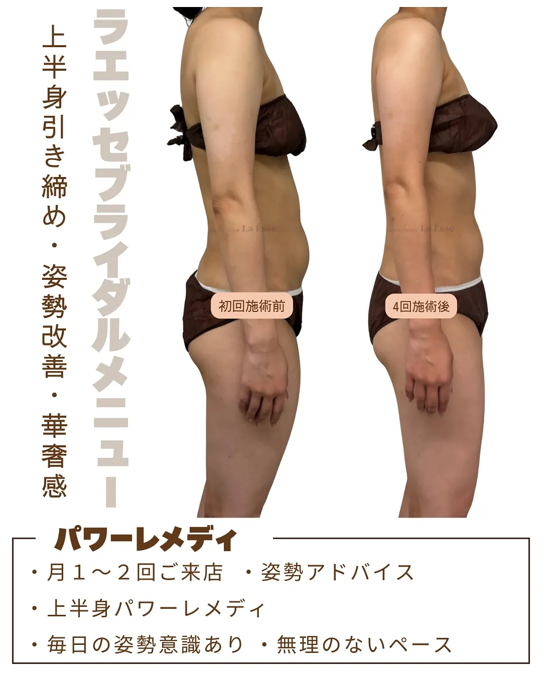 反り腰改善💯◎ サロンケア×姿勢意識で別人級の美ボディへ🥰✨