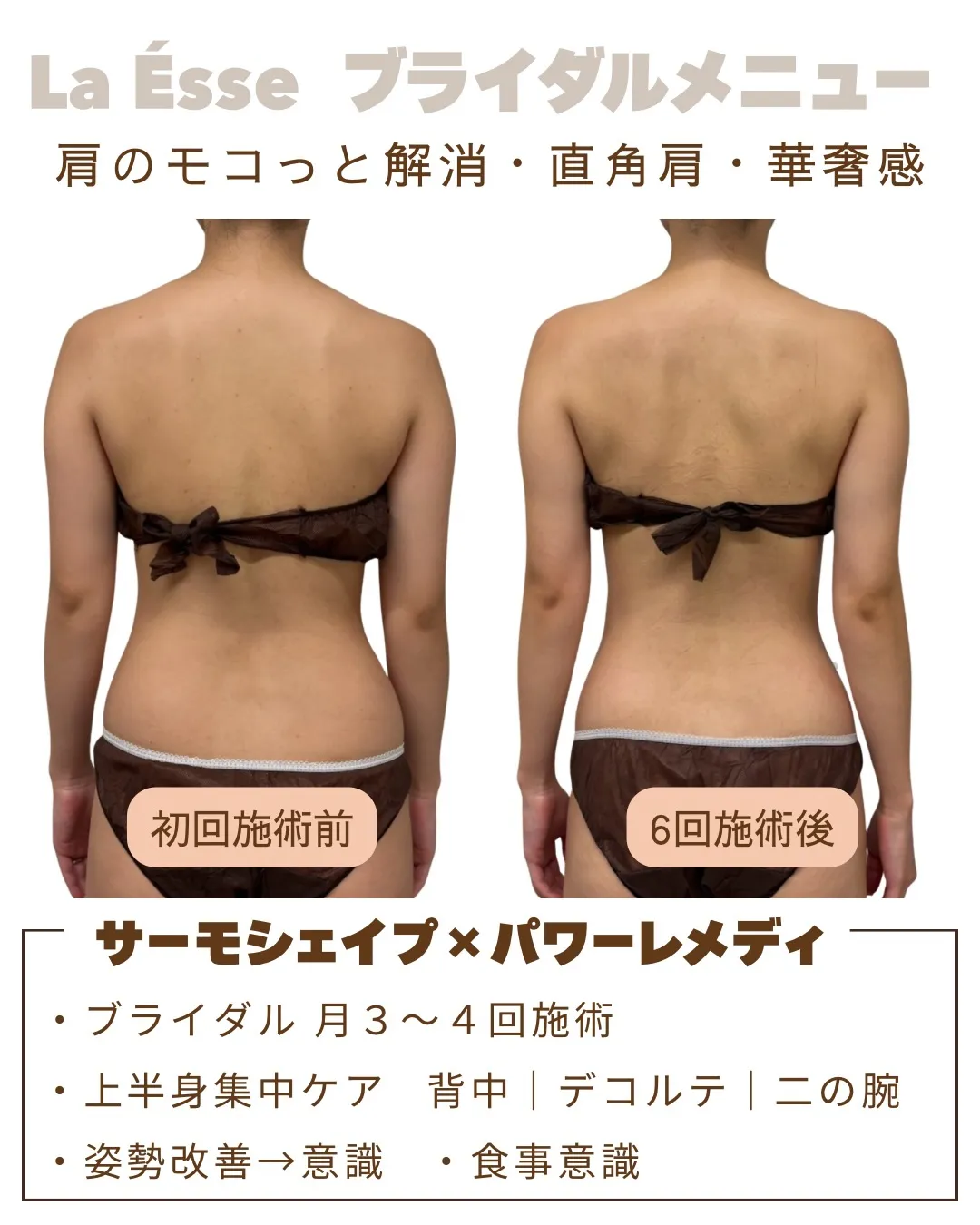 憧れの直角肩！引き締まったお背中はドレス映え間違いなし！💍