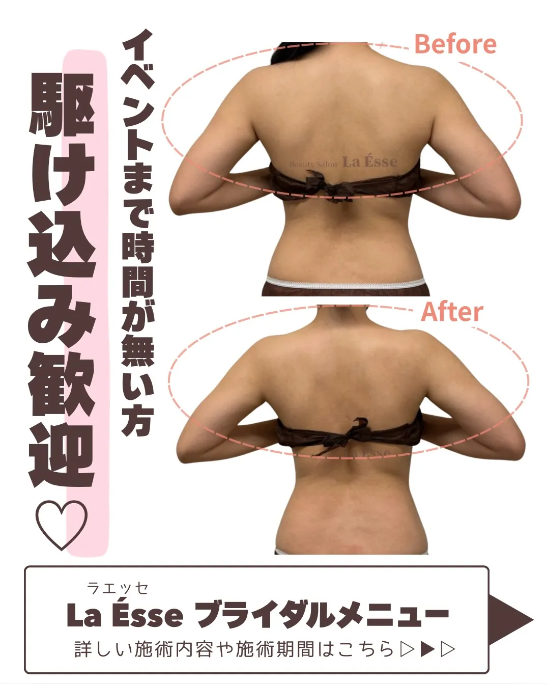 挙式や前撮りまで時間がない方お任せください💪🏻✨