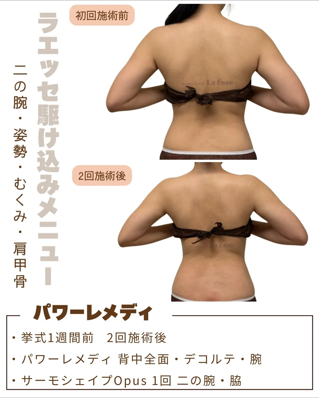 挙式や前撮りまで時間がない方お任せください💪🏻✨