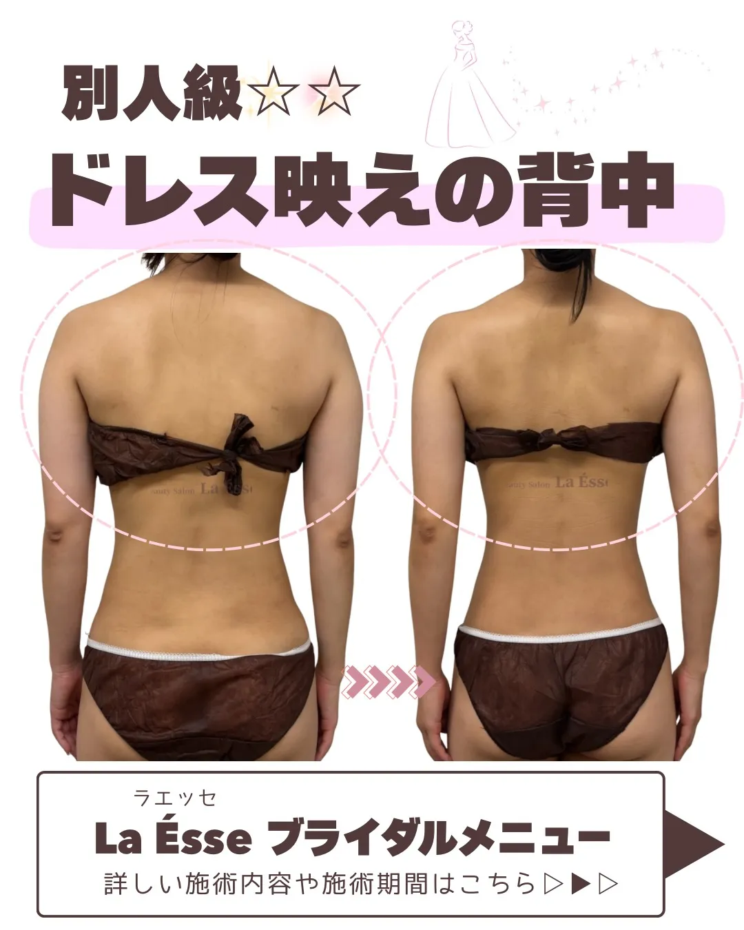 極上筋膜リリースで無理なく美ボディメイク！👰🏻‍♀️