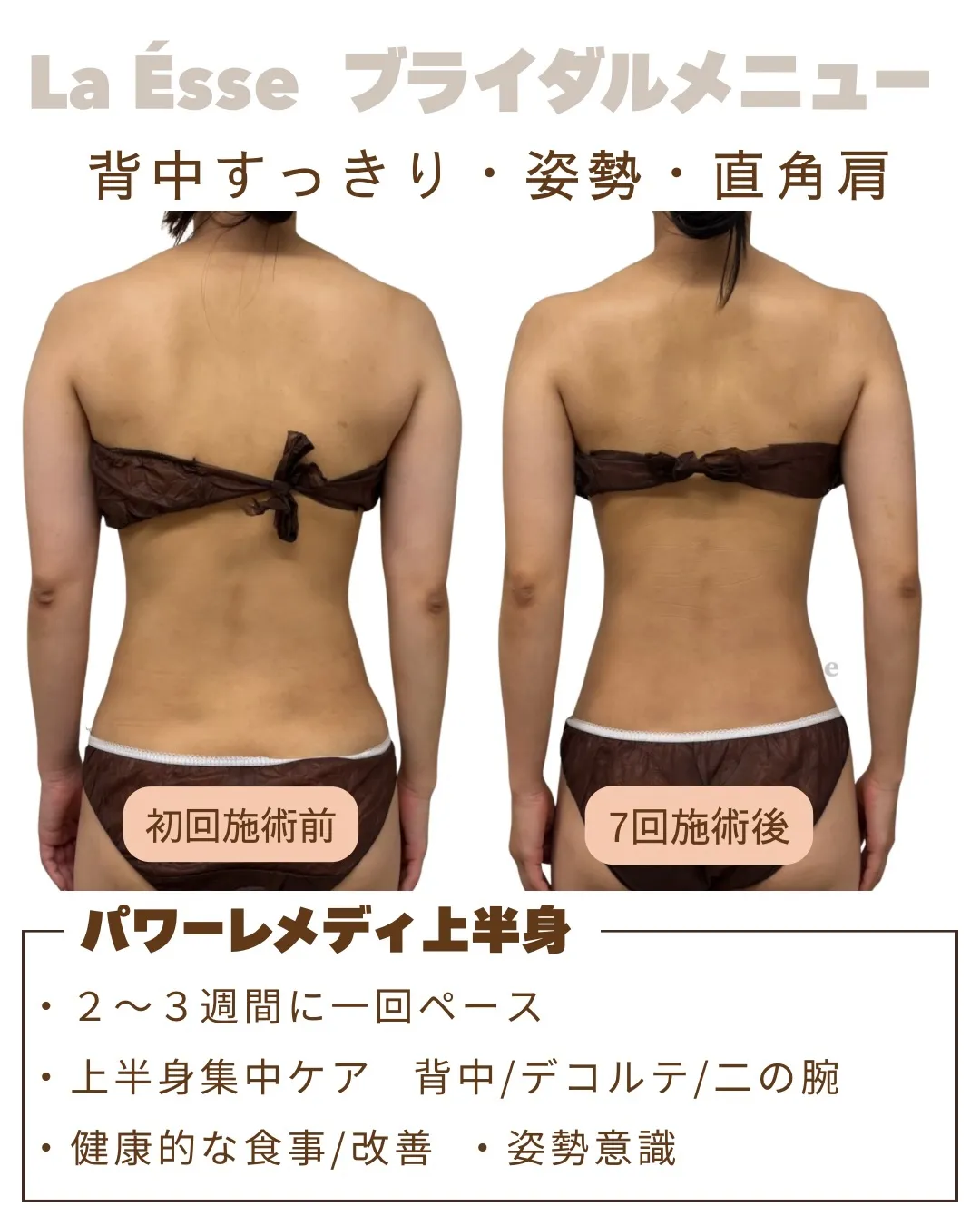 極上筋膜リリースで無理なく美ボディメイク！👰🏻‍♀️🩵