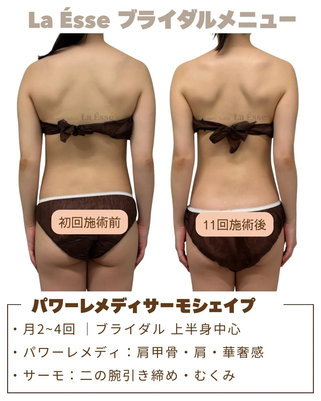 美しい天使のはねGET💍 きれいな肩甲骨へ仕上げます!!