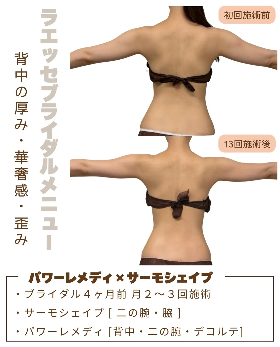 華奢感UP✨ 背中の厚みもとれドレス映えするお背中へ👗🫧💎