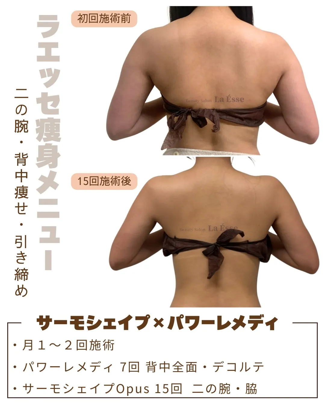 背中や後ろ姿気にしていますか？？意外と年齢がでるからこそケア...