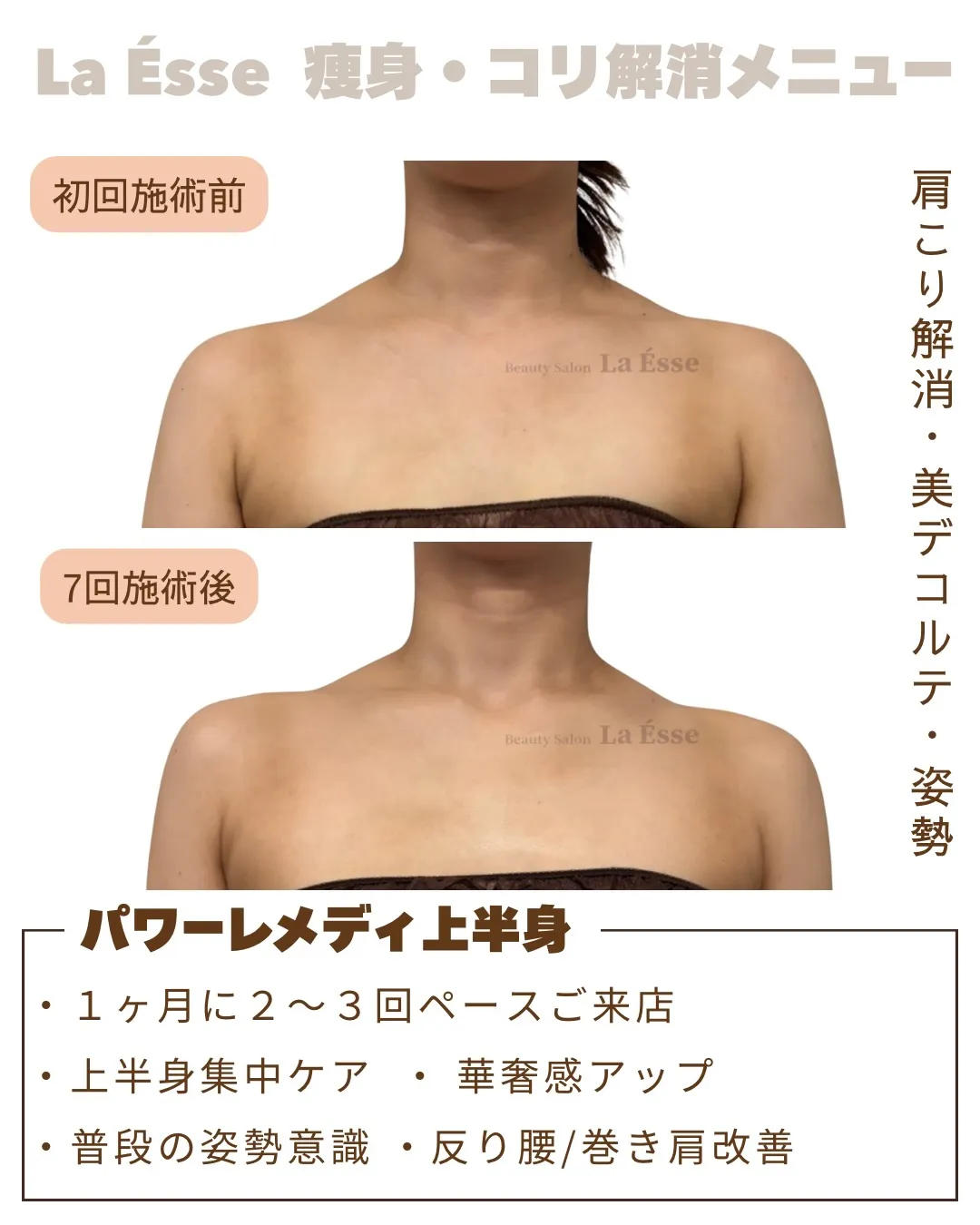 モリっと肩の解消も鎖骨もキレイに出して美しいデコルテへ💪🏻✨