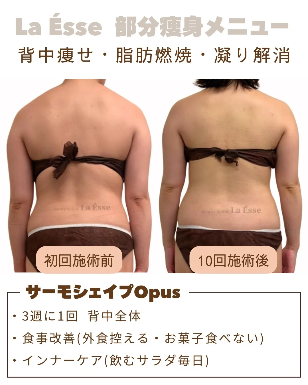 ぷにっとしたお背中・後ろ姿 卒業してマイナス10歳以上へ👏🏻