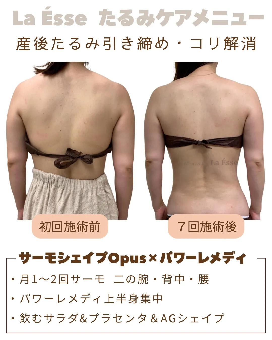 産後の背中のたるみを夏までに徹底ケア!💪🏻✨