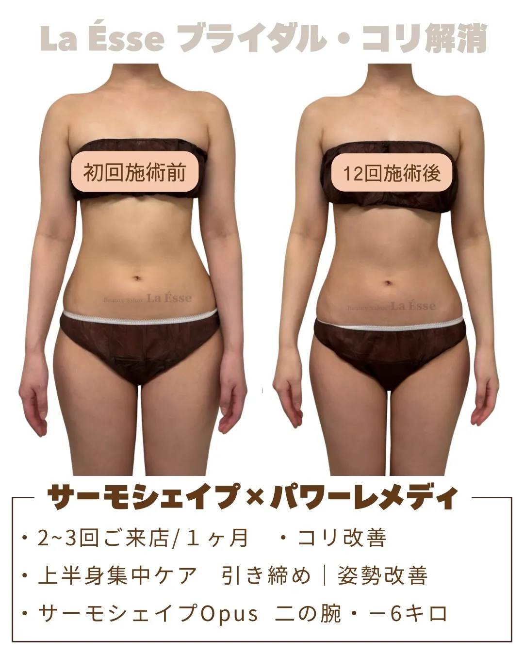 憧れの直角肩！！美デコルテでドレス映え間違いなし！💍