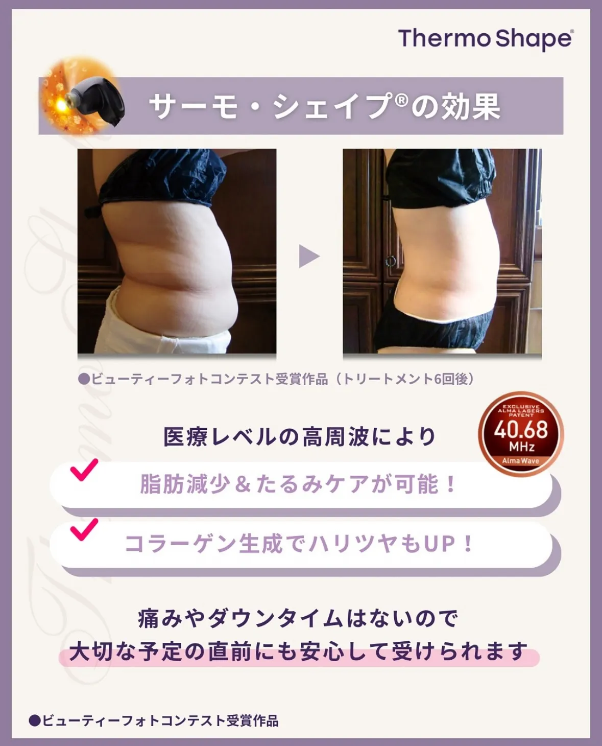 ⁡結果が出るからこそ取り扱いを決めたサーモシェイプOpus🔥