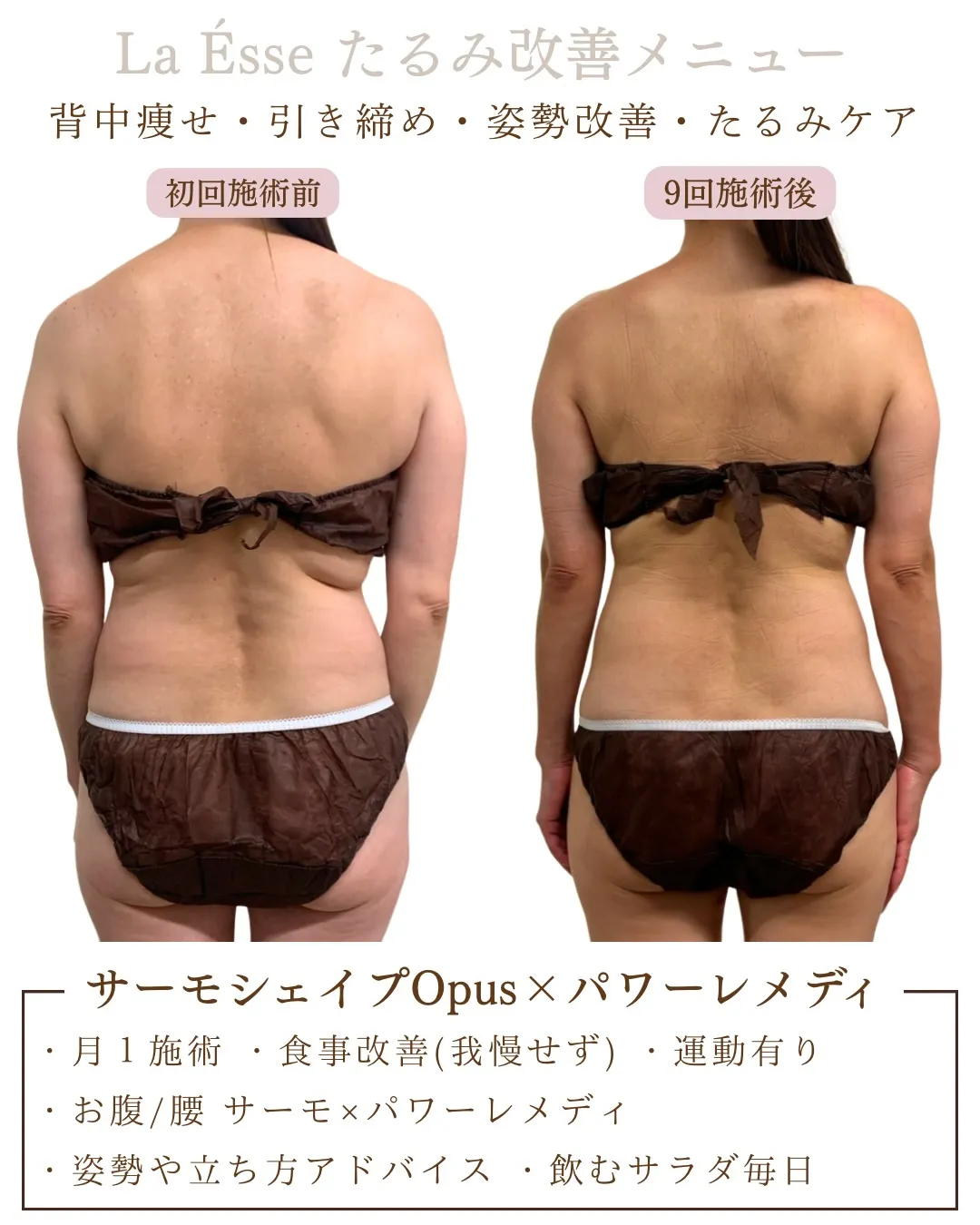 オーダーメイドメニューでたるみ改善︎👍🏻 マイナス10歳の後...