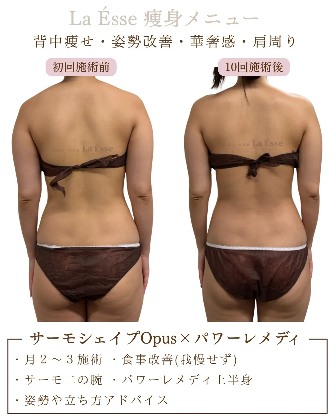 ぷにっとしたお背中・後ろ姿から卒業しましょう！👰🏻‍♀️