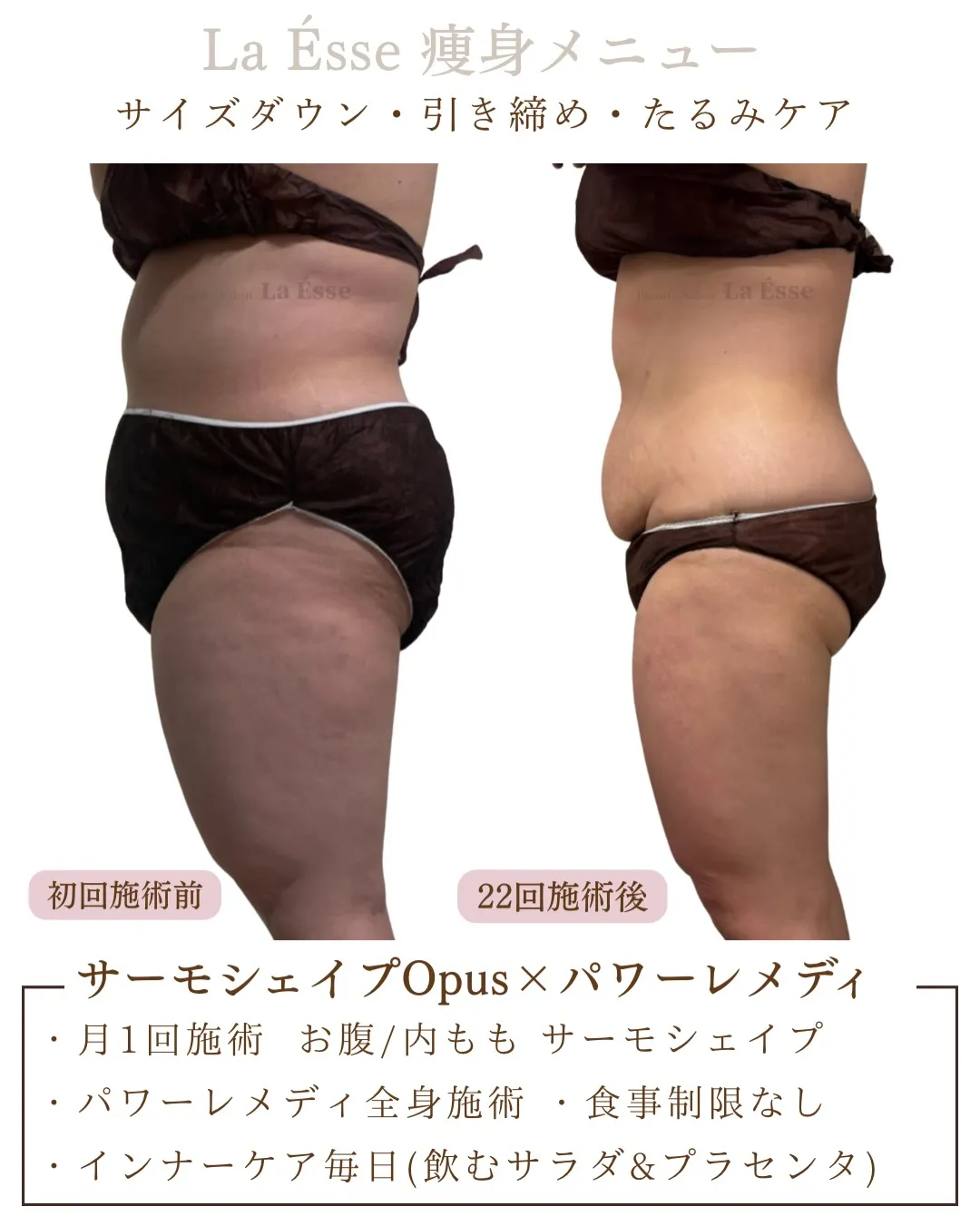 頑張りすぎない痩身でもボディラインはちゃんと変わります💪🏻✨