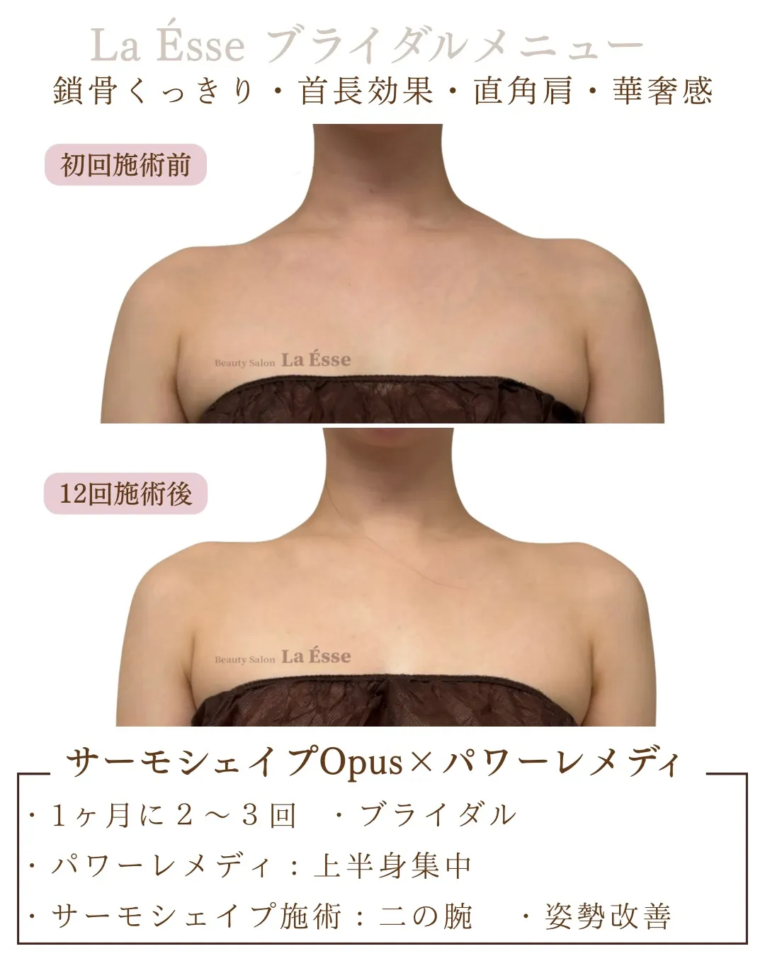 花嫁様必見！👰🏻‍♀️ いらない肩のもりっと感撃退👊🏻💥 