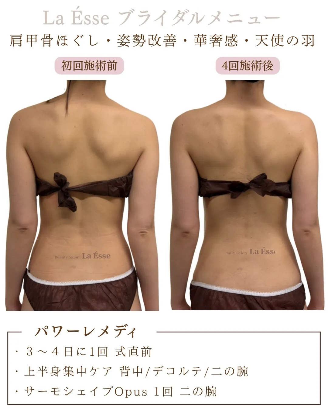 背中も肩甲骨も美しく！さらに自信のあるお体へバージョンアップ...