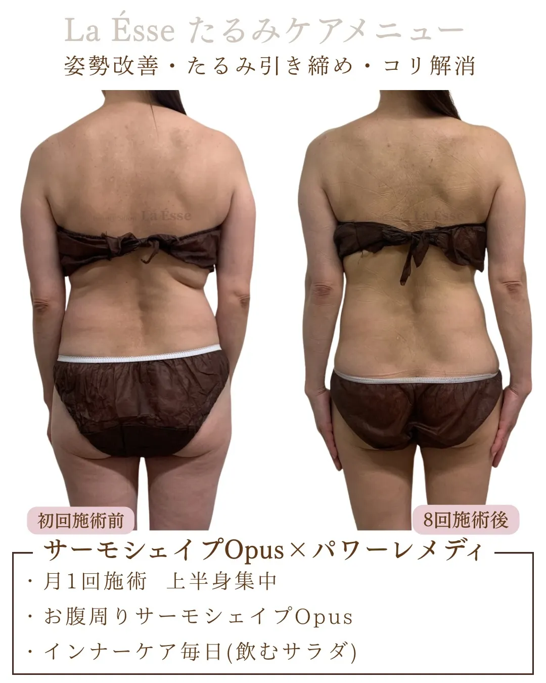 背中や後ろ姿気にしていますか？？意外と年齢がでるからこそケア...