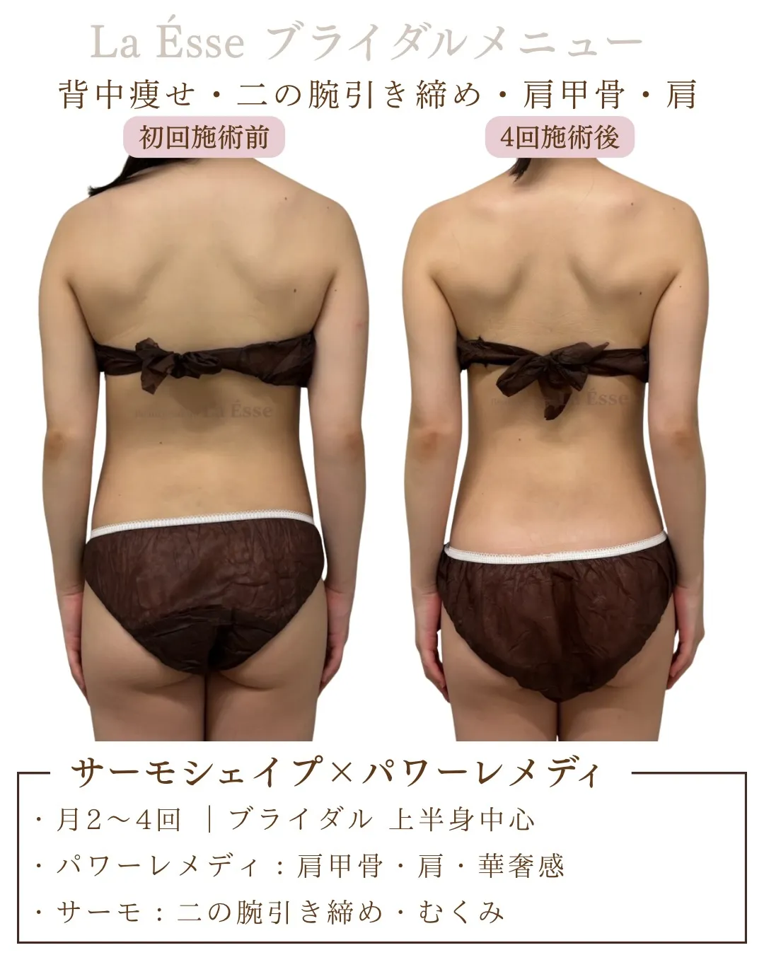 美しい後ろ姿GET💍 花嫁様専用美ボディメイク💪🏻✨