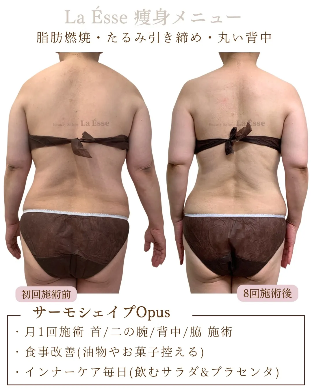 脂肪吸引を選ばなくてもエステで結果を得られる😳✨