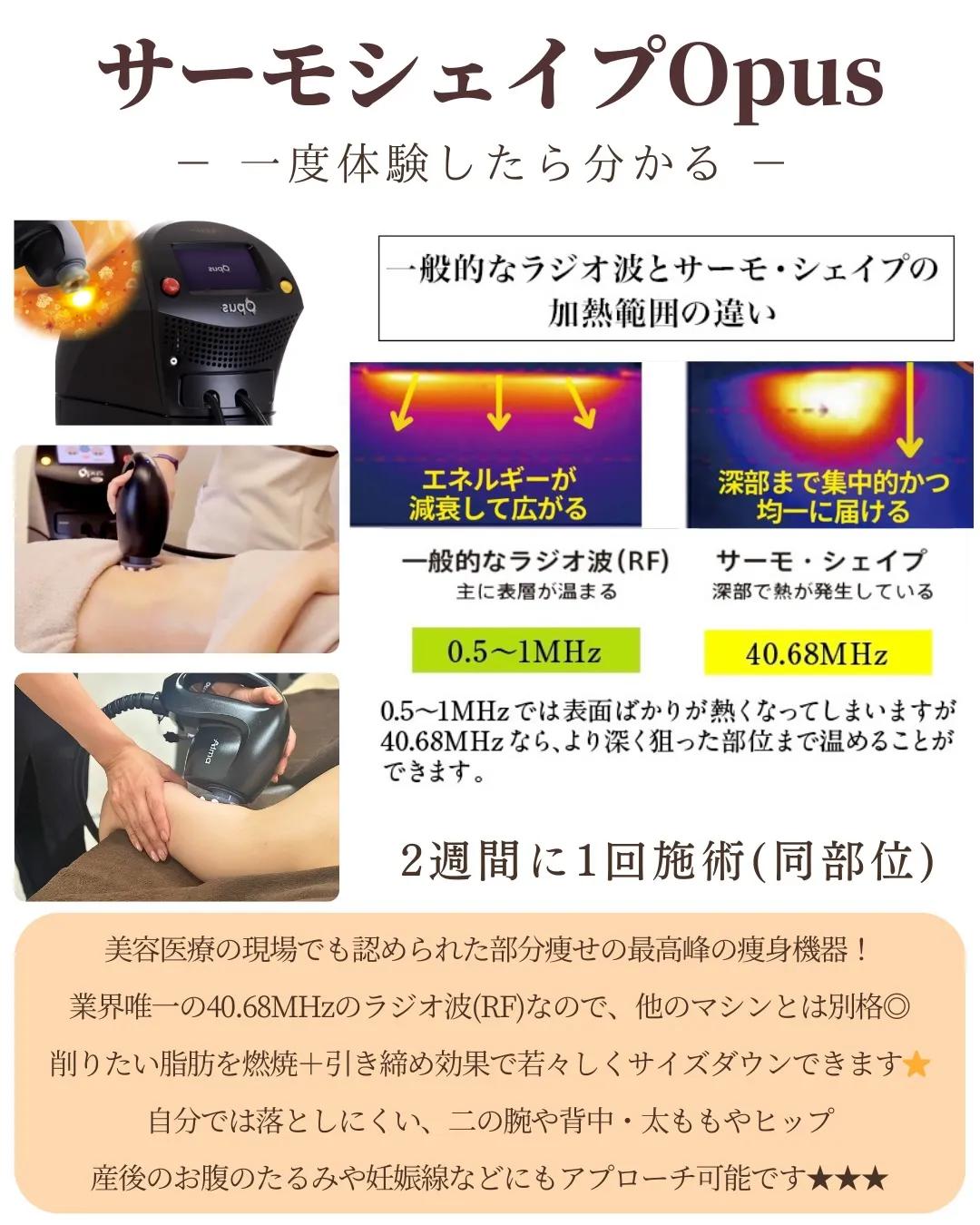 業界最高峰のサーモシェイプOpusってしってますか？