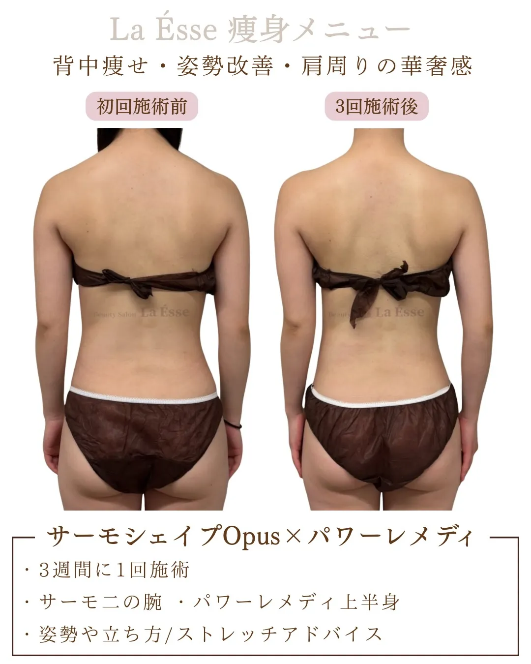 挙式や前撮りまで時間がない方お任せください💪🏻✨