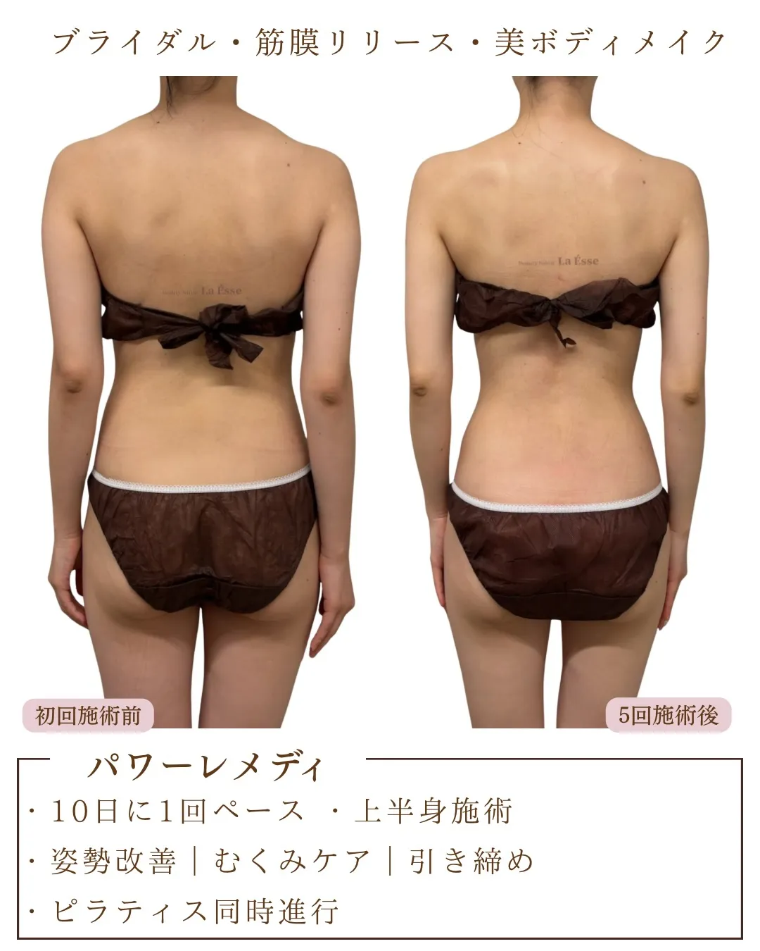 【京都の花嫁様必見】ただ細いだけじゃない美しい体へ💎