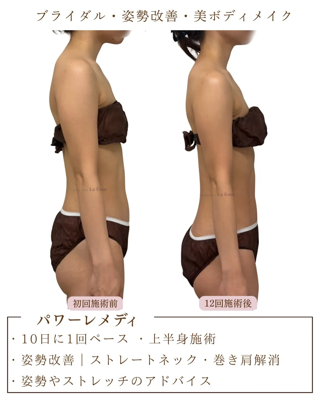 ストレートネック改善で、首長効果&小顔効果𝗚𝗘𝗧!