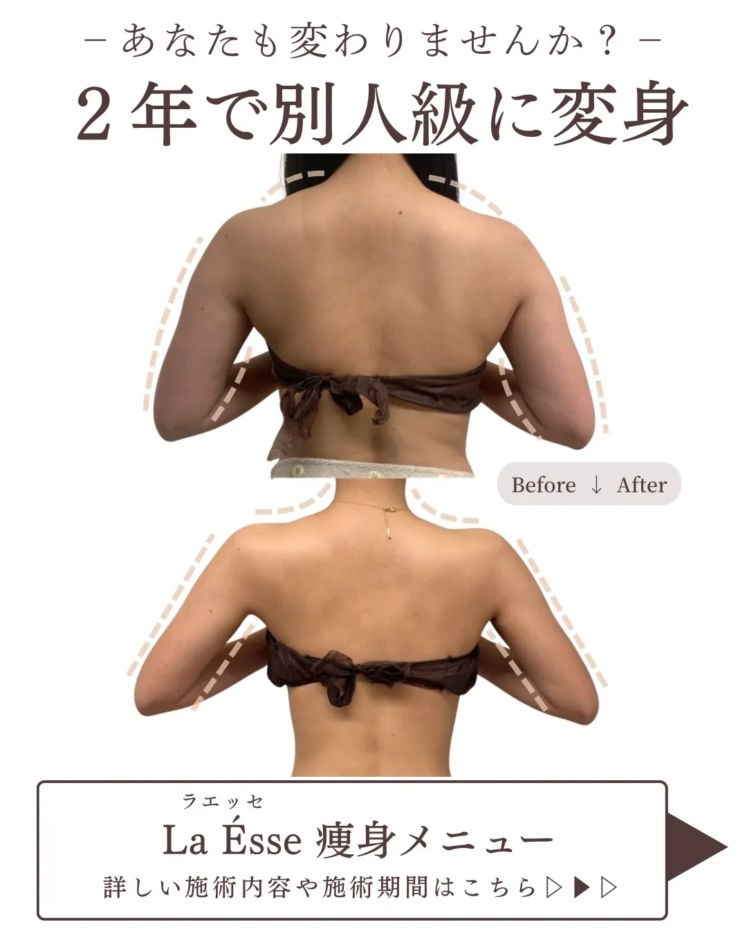 ここまで⁡別人級に変わるならやるしかない！烏丸痩身サロン💪🏻