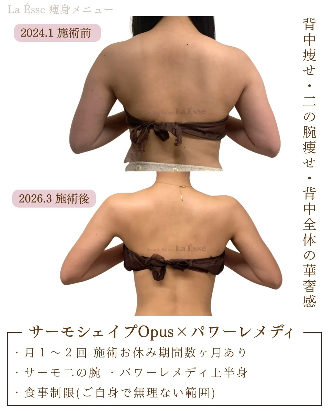 ここまで⁡別人級に変わるならやるしかない！烏丸痩身サロン💪🏻