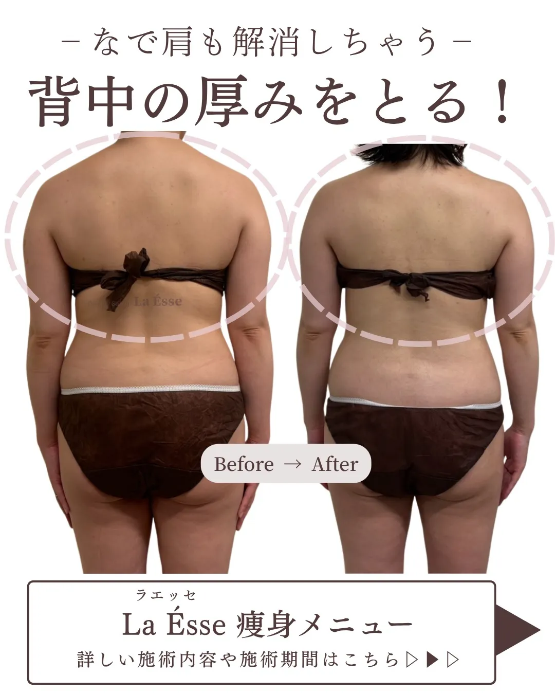 背中や後ろ姿気にしていますか？？意外と年齢がでるからこそケア...