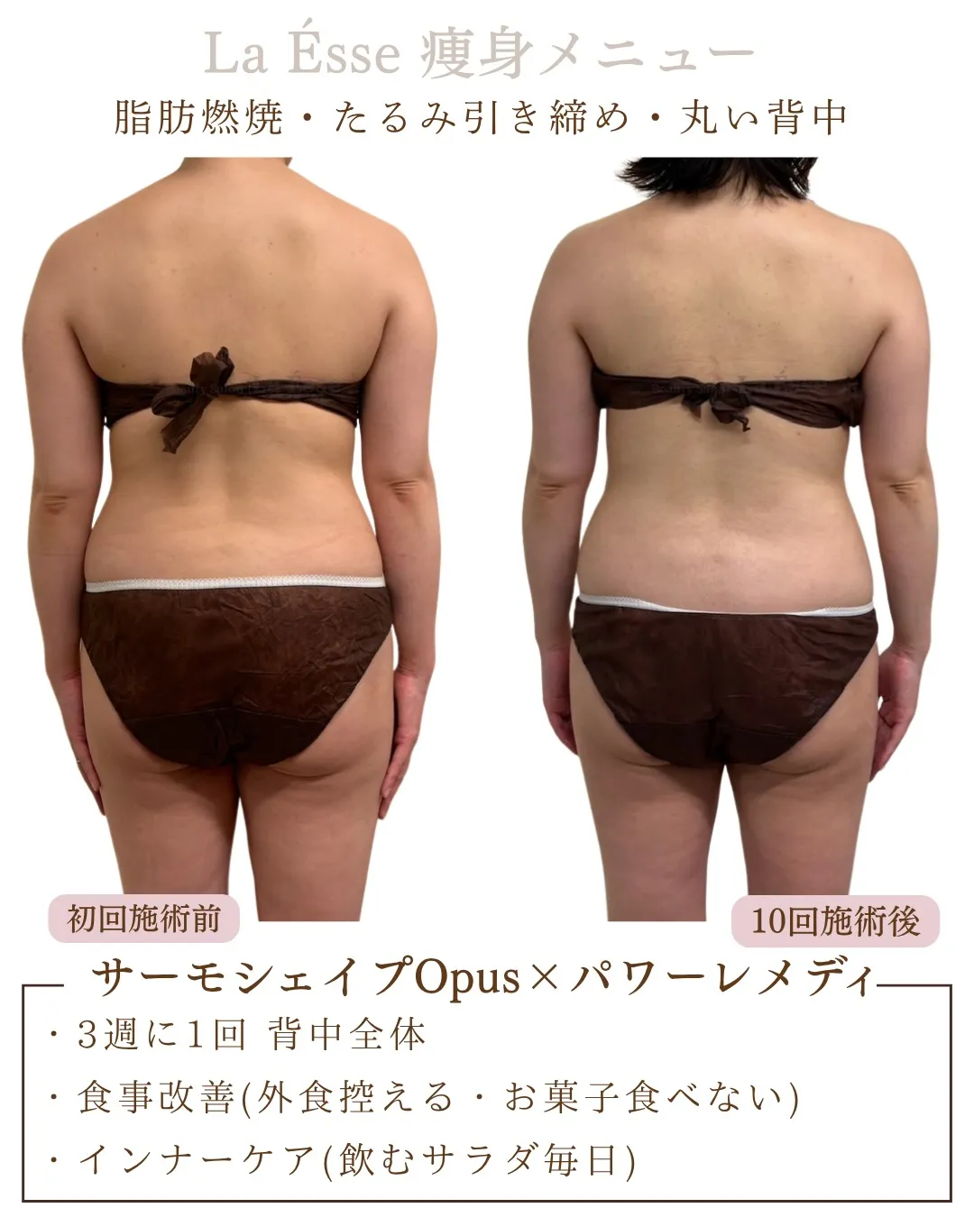 背中や後ろ姿気にしていますか??意外と年齢がでるからこそケア...