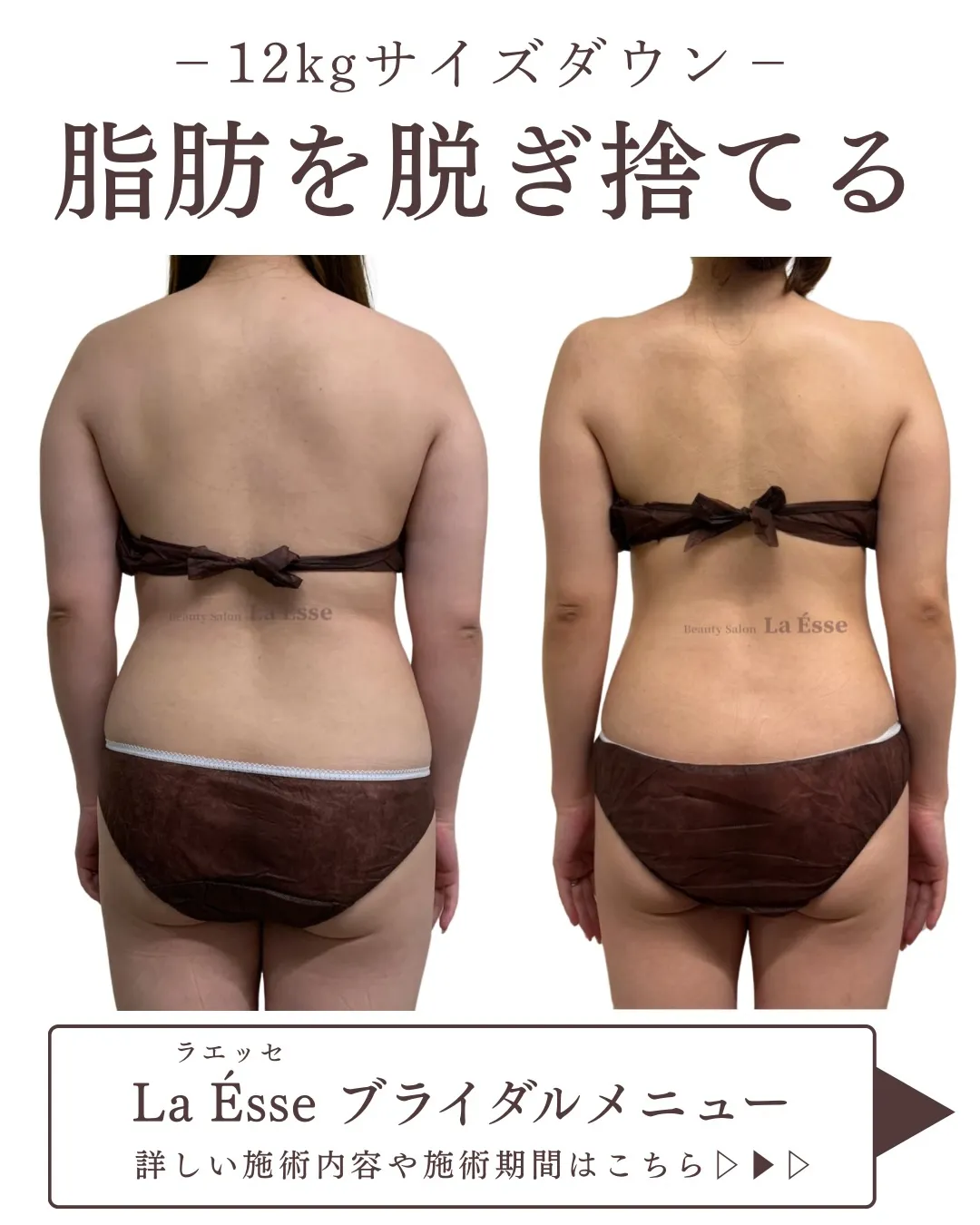 花嫁様必見💎 月1回でもここまで変わる…？🥹✨